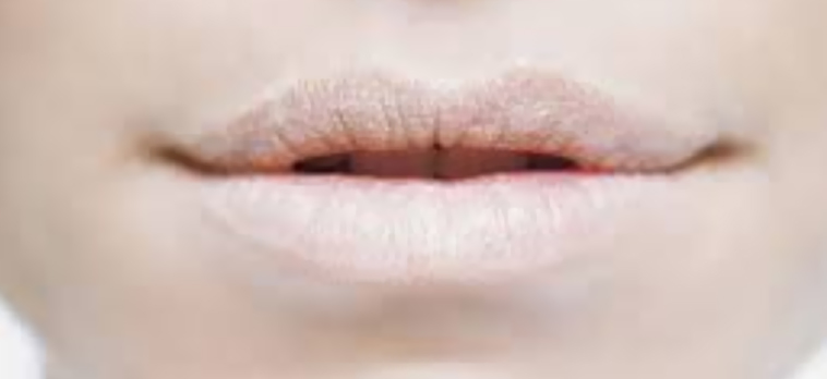 blog1